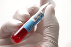 First PSA Test Blood Sample